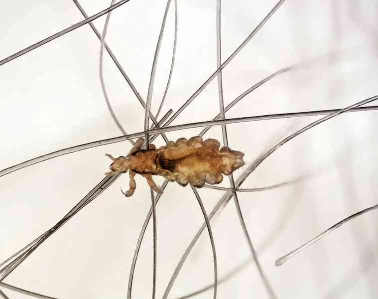 louse - arthropods with detailed facts including diet, lifespan, weight and habitat information